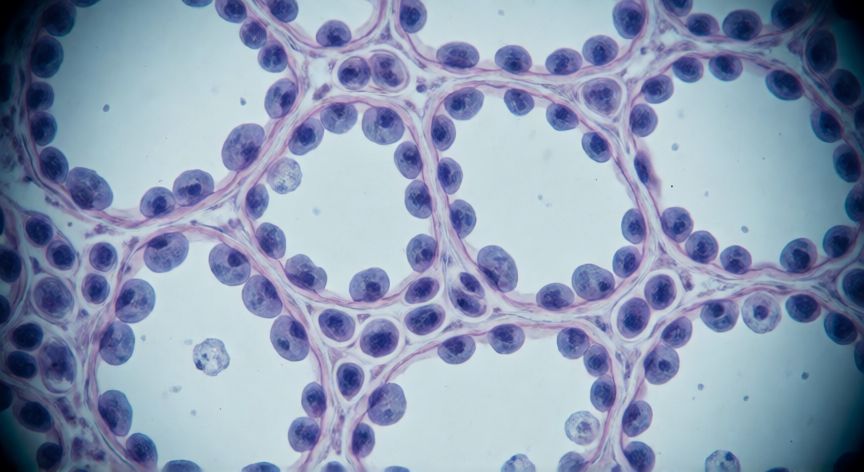 covid 19 agente causal, Tejido pulmonar humano visto al microscopio mostrando la interacción celular