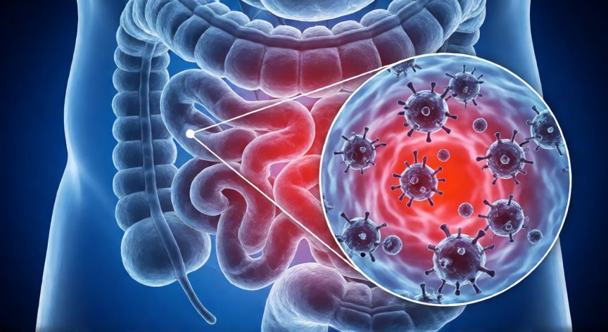covid 19 diarrea, Diagrama anatómico de la interacción del virus SARS-CoV-2 con las células del intestino