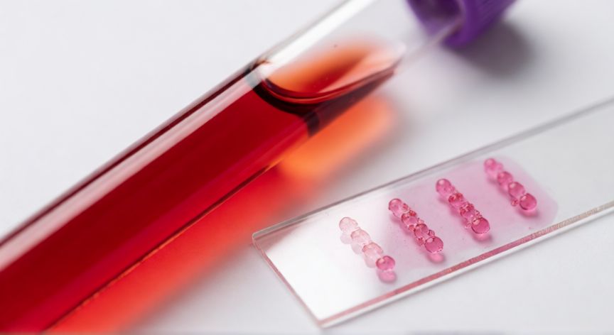 covid 19 igg, Tubo de ensayo con suero sanguíneo y microscopio en laboratorio médico
