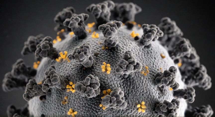 covid 19 nombre completo, Vista microscópica de un partícula de coronavirus mostrando su estructura de corona
