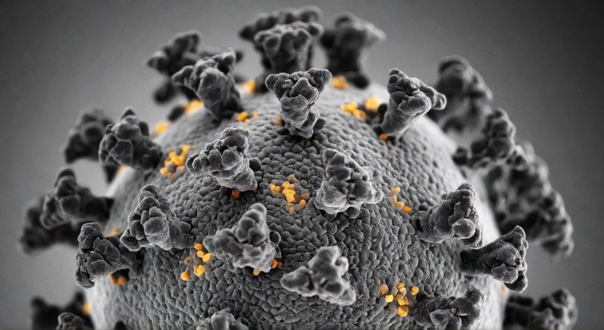 covid 19 porque 19, Vista microscópica de un coronavirus mostrando su estructura corona