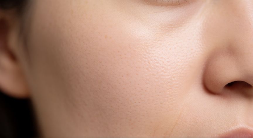 mejor producto para limpiar puntos negros, Piel limpia y poros visiblemente más claros tras el tratamiento con ácido salicílico